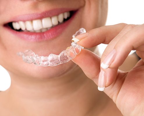 smiling female holding invisible teeth braces