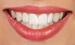 invisalign-top-provider-asheville-nc Woman with Invisalign aligner smiling for picture