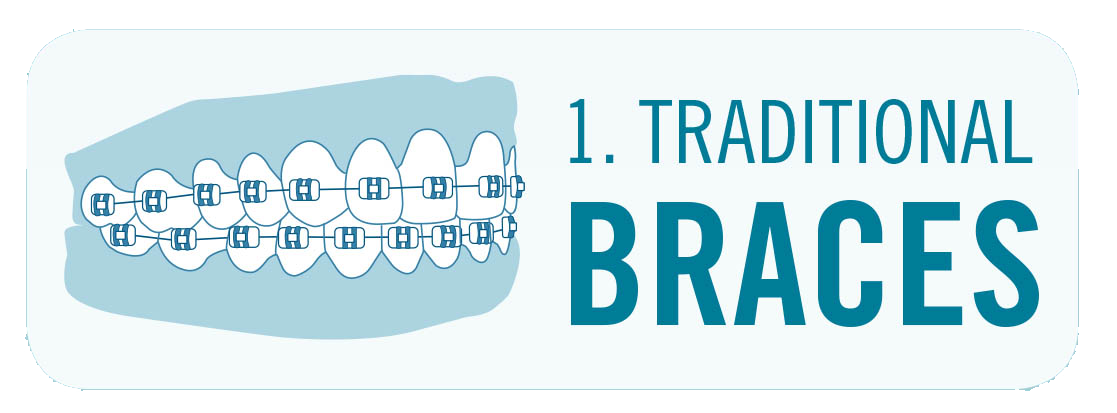 traditional braces image with teeth