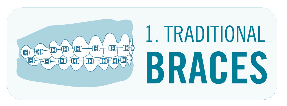 traditional braces image with teeth