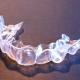 Invisalign aligner used by teenager in Asheville, NC