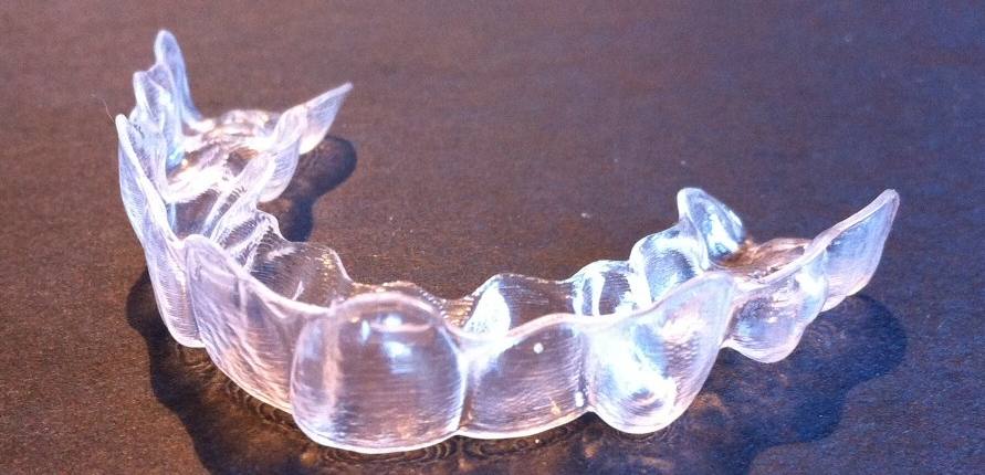 Invisalign aligner used by teenager in Asheville, NC