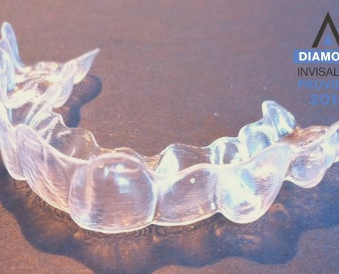 Invisalign aligner tray at patient's house in Hendersonville, NC