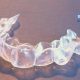 Invisalign aligner tray at patient's house in Hendersonville, NC