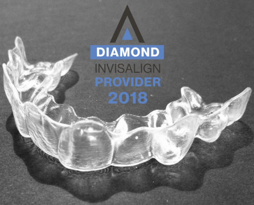 Invisalign aligner sent to a patient in Hendersonville, NC