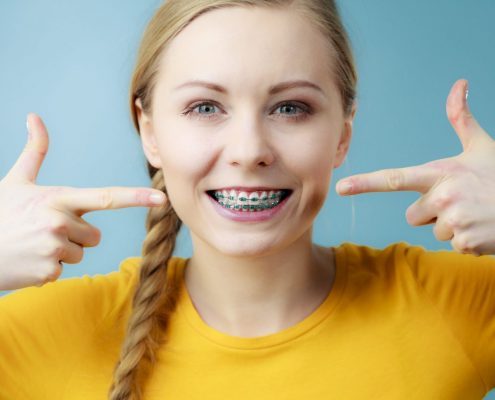 Woman who has gotten blue colored braces in Western North Carolina