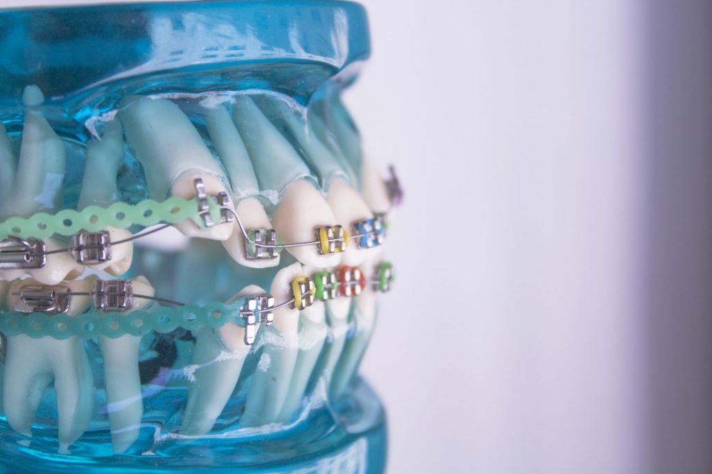 Orthodontist in North Carolina shows how braces move the teeth