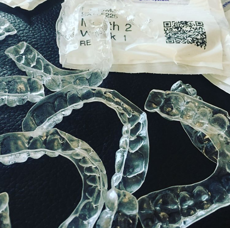 Damaged invisible aligners in North Carolina