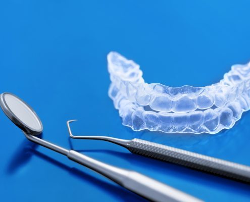 Orthodontic retainer used after braces in North Carolina