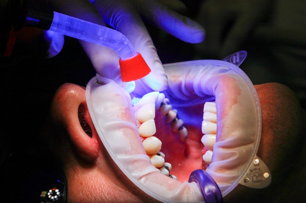 Person getting teeth whitened after braces in Asheville