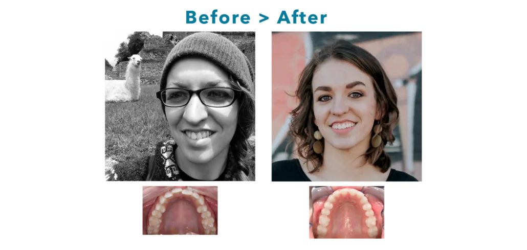 Impressions Before After
