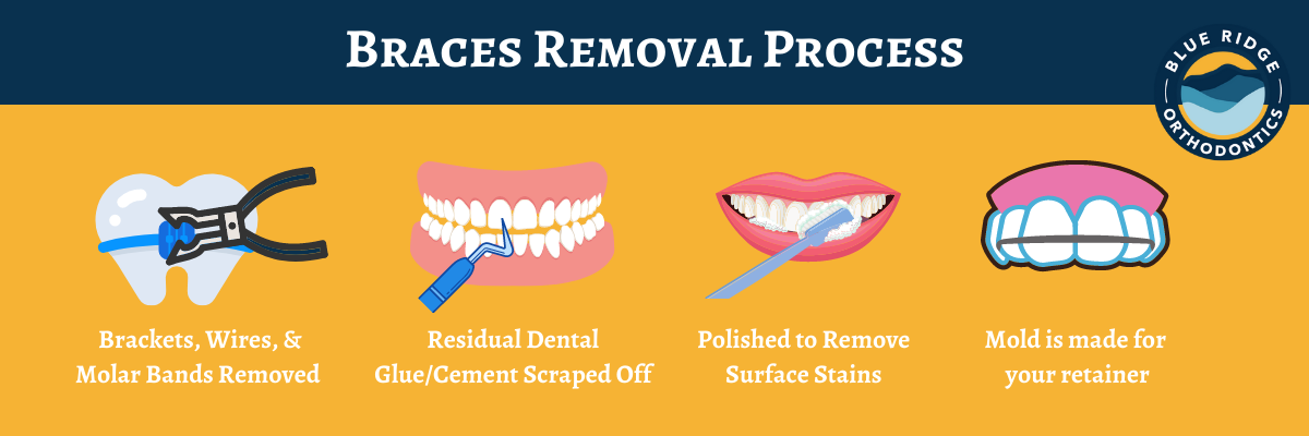 Braces Removal Process