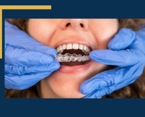 Invisalign for Teens - image of someone getting Invisalign put into their mouth