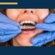 Invisalign for Teens - image of someone getting Invisalign put into their mouth