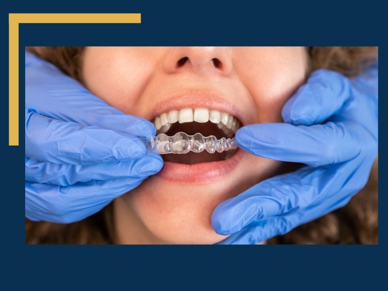 Invisalign for Teens - image of someone getting Invisalign put into their mouth