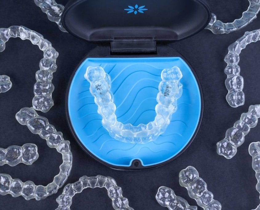 Braces Info