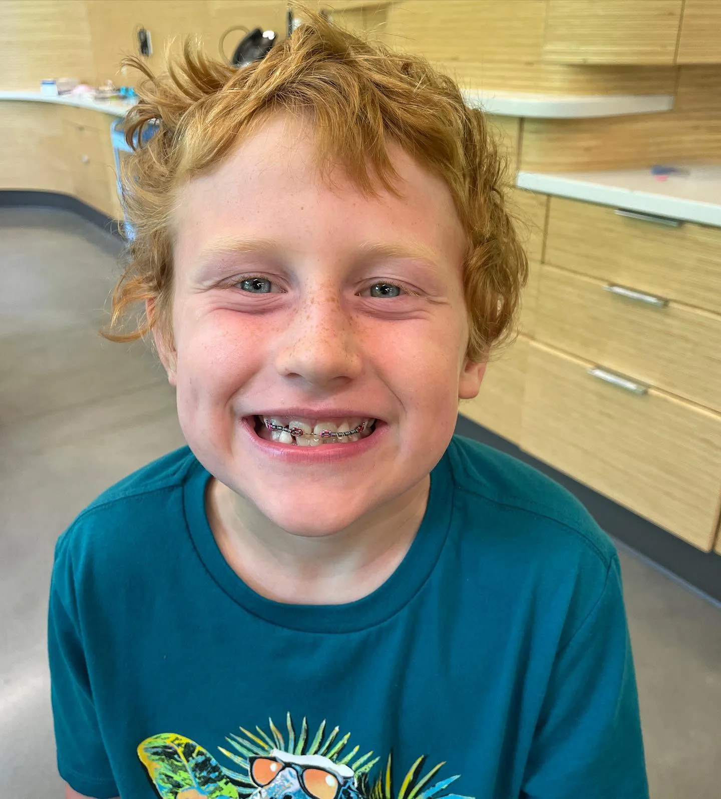 braces Boy smiles with braces on