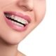 Blue Ridge Orthodontics teens get braces