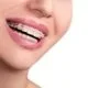 Blue Ridge Orthodontics teens get braces
