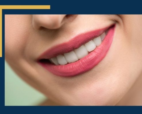 Teeth Whitening Is it Better at Home or the Orthodontist Office - image of a beautiful smile with white teeth