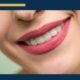 Teeth Whitening Is it Better at Home or the Orthodontist Office - image of a beautiful smile with white teeth