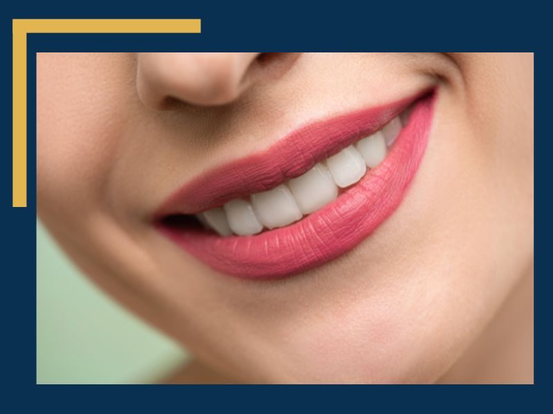 Teeth Whitening Is it Better at Home or the Orthodontist Office - image of a beautiful smile with white teeth