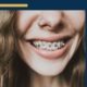 Debunking Myths about Wisdom Teeth and Braces - young girl with brances