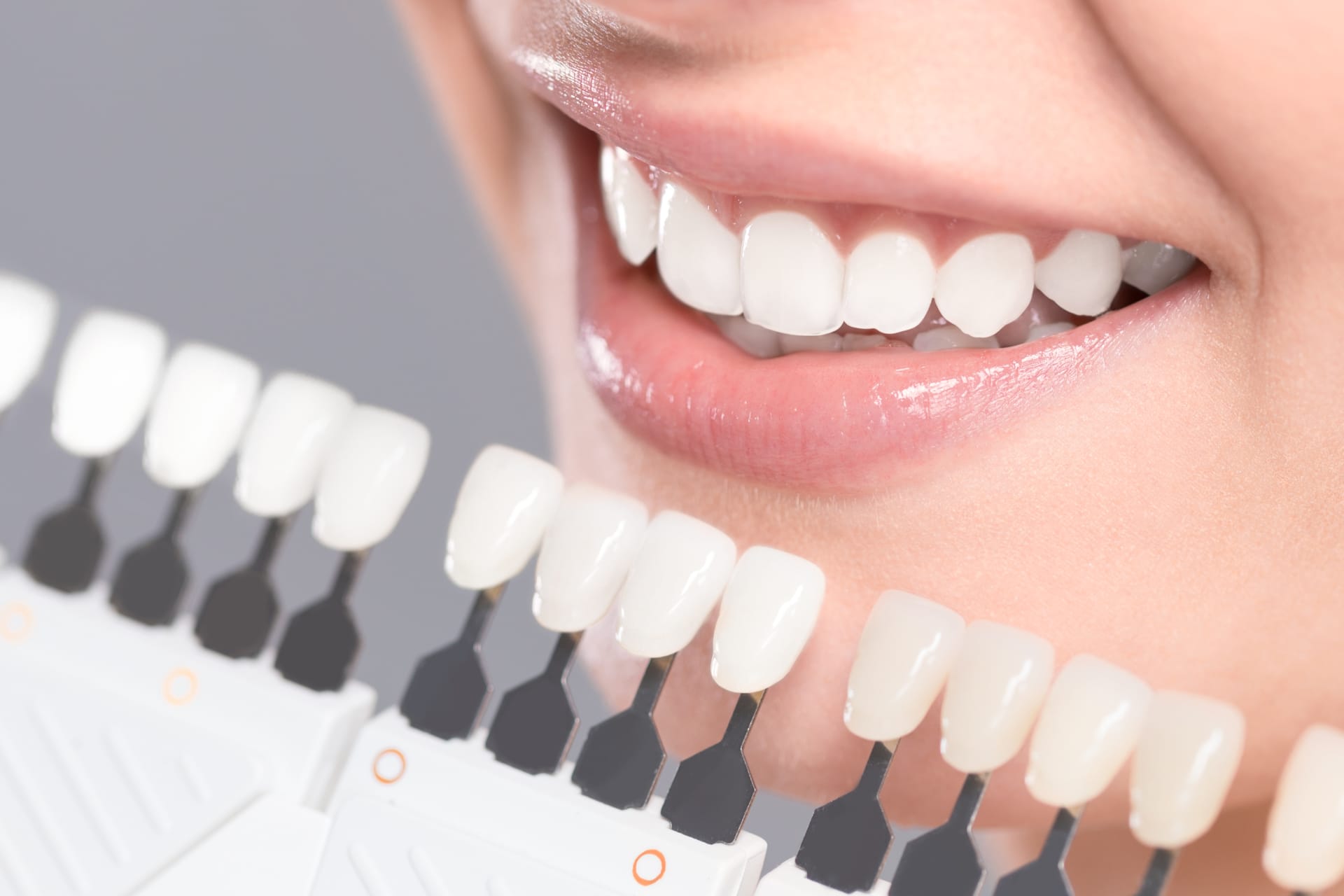 Beautiful smile and white teeth of a young woman.
